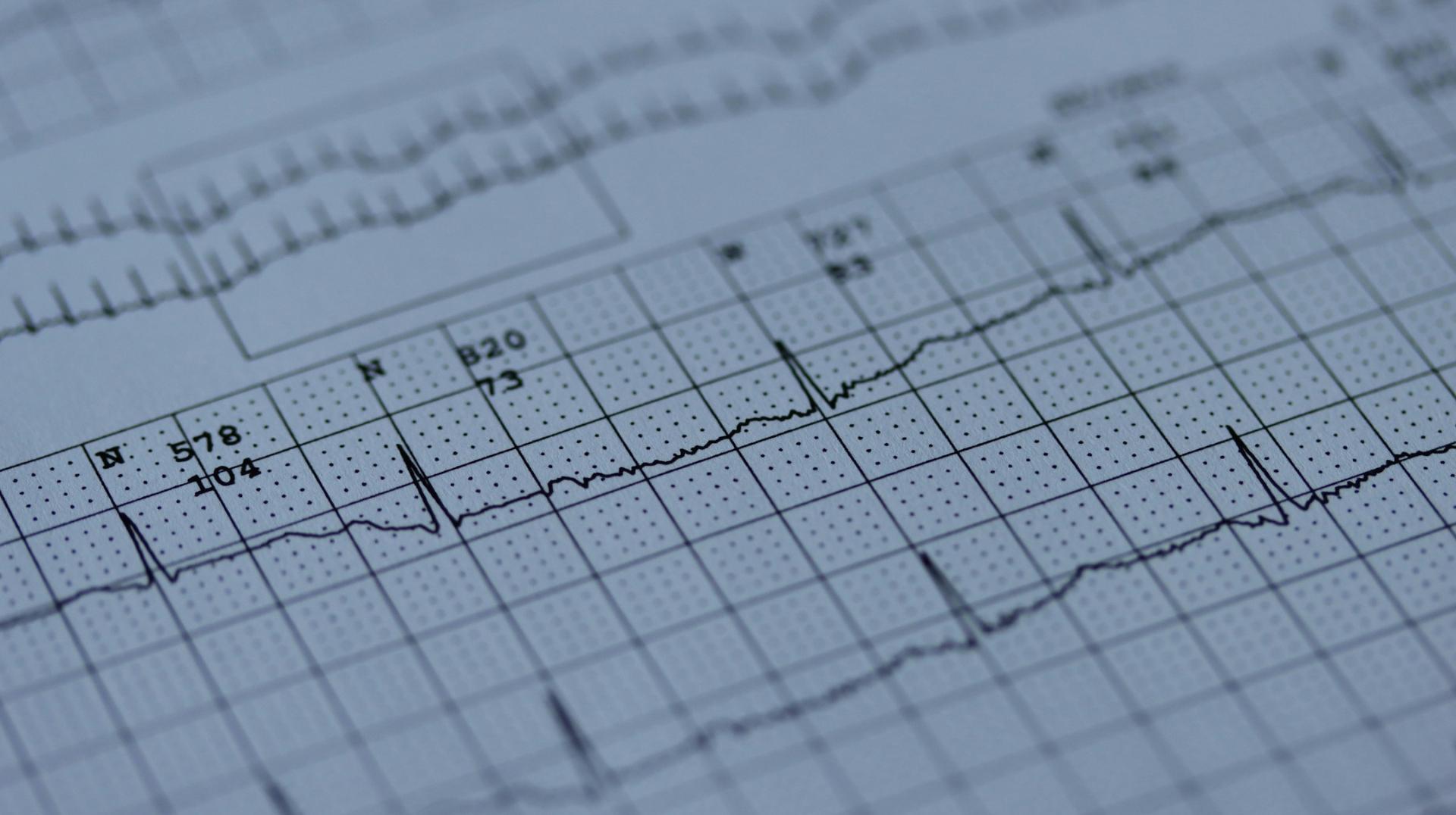Cardiac Sense